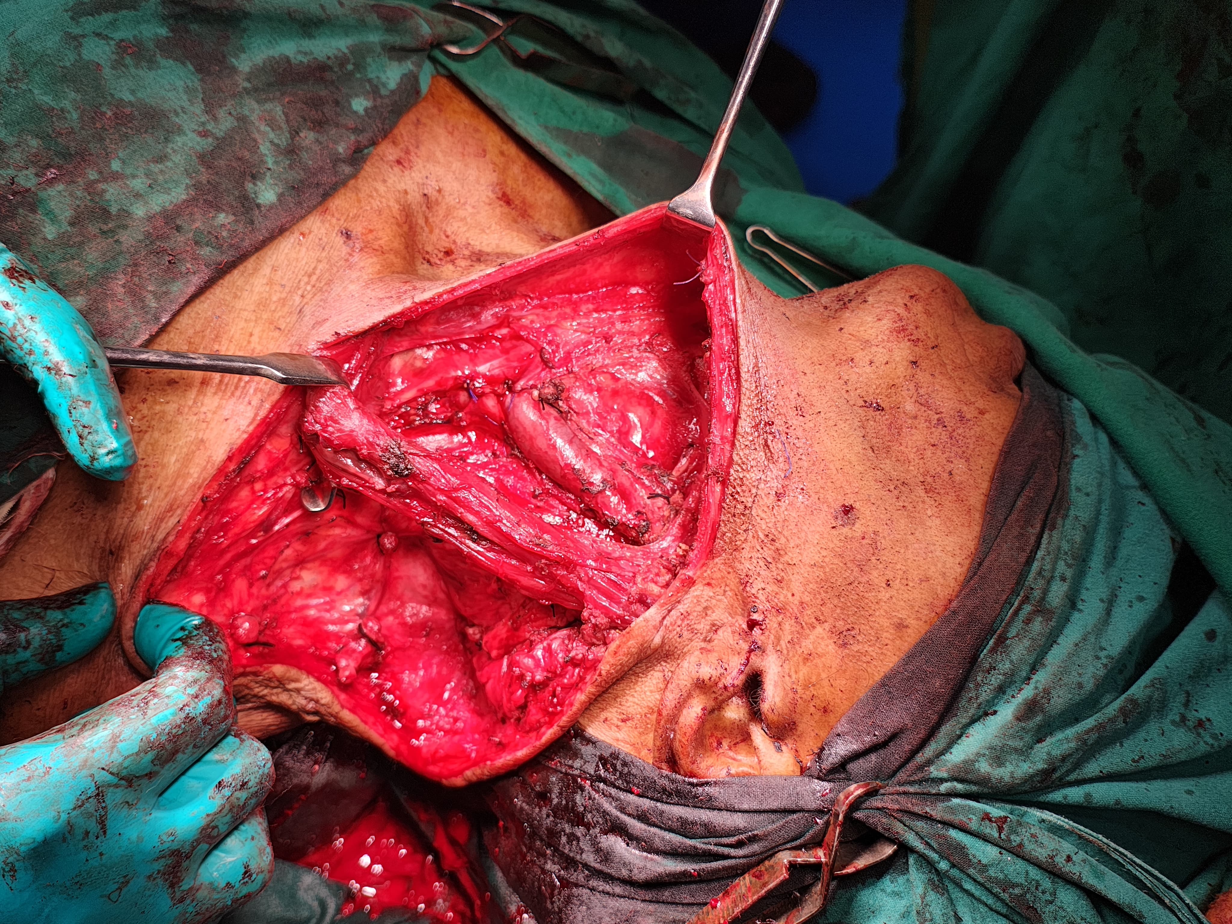 general surgeon in kolkata - Dr. Kushankur Guha