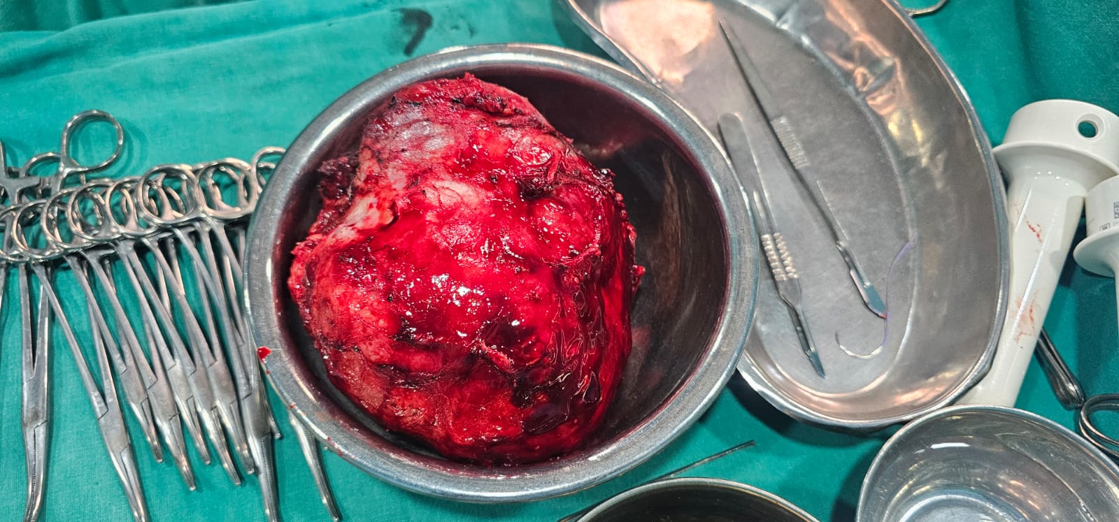 general surgeon in kolkata - Dr. Kushankur Guha