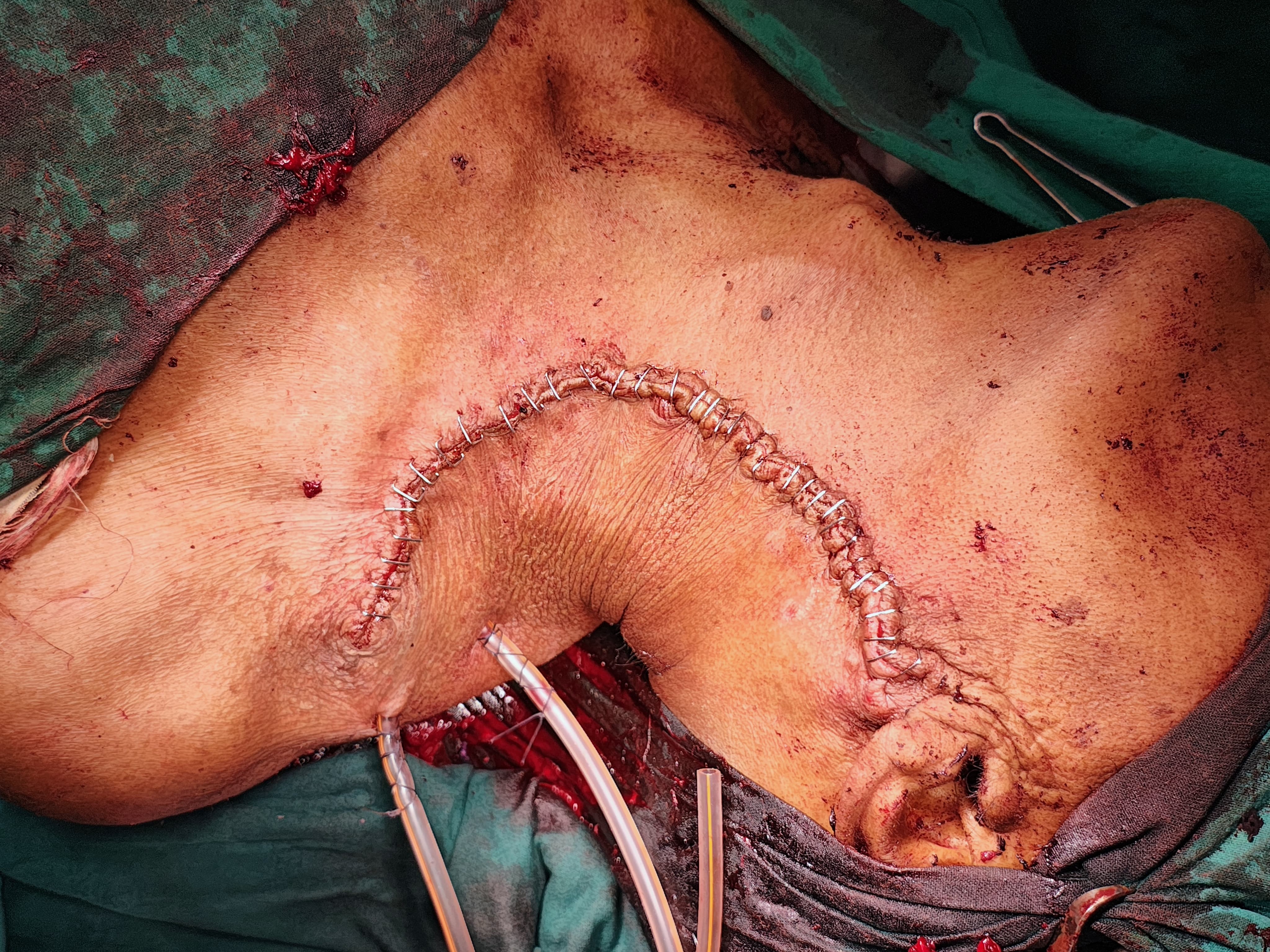 general surgeon in kolkata - Dr. Kushankur Guha